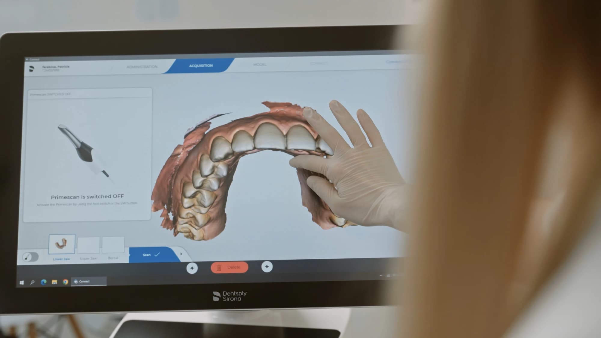 Zubná protéza zhotovená na mieru v ambulancii Planeta Dental Clinic v Žiline.