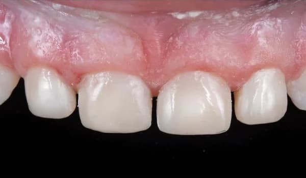 Estetické premeny - prípad 13 – po ošetrení v Planeta Dental Clinic v Žiline